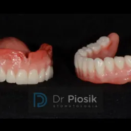 Dwie protezy zębowe na czarnym tle, z widocznym logo gabinetu stomatologicznego Dr Piosik w dolnej części kadru.