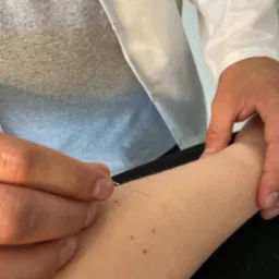 Cienka igła wbijana w skórę przedramienia pacjenta przez osobę w białym fartuchu, widoczne pieprzyki na skórze.