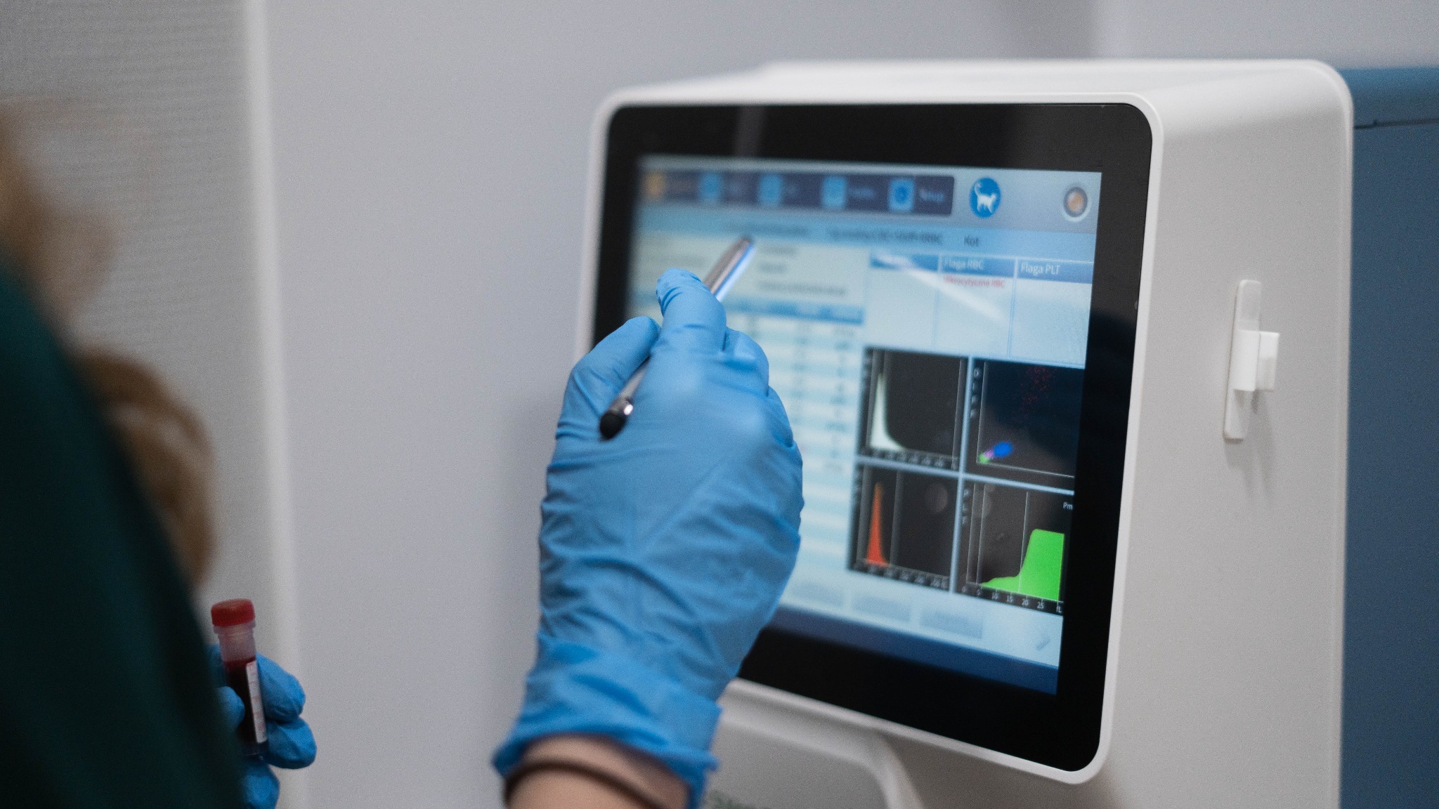Osoba w niebieskich rękawiczkach laboratoryjnych obsługuje ekran dotykowy analizatora laboratoryjnego, trzymając probówkę z krwią w drugiej ręce.