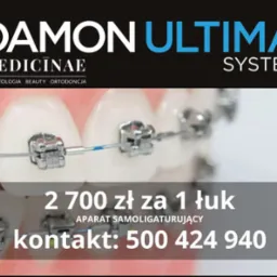 Aparat samoligaturujący Damon Ultima na zębach, promowany w Opole. Cena za łuk: 2700 zł. Kontakt telefoniczny widoczny na zdjęciu.