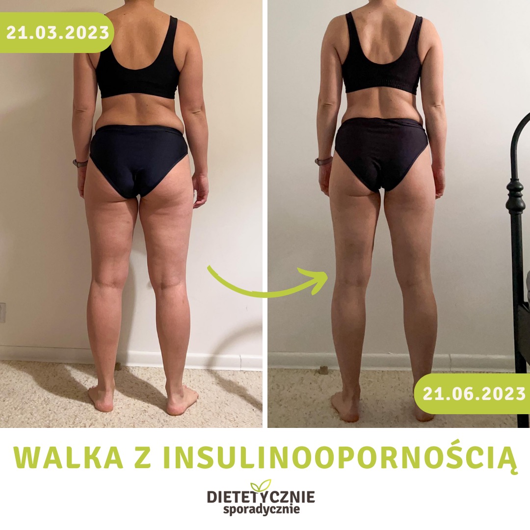 Porównanie sylwetki kobiety od tyłu, przed i po, z datami 21.03.2023 i 21.06.2023, ukazujące efekty walki z insulinoopornością, z logo firmy dietetycznej w dolnej części.