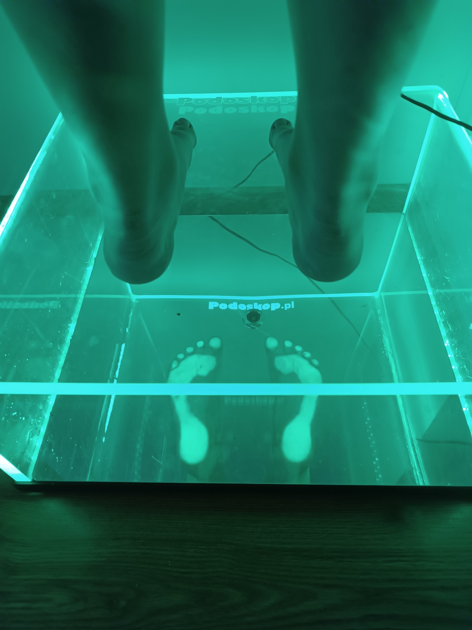 Stopy pacjenta na podoskopie z zielonym podświetleniem, widoczne odbicie stóp na lustrzanej powierzchni urządzenia.