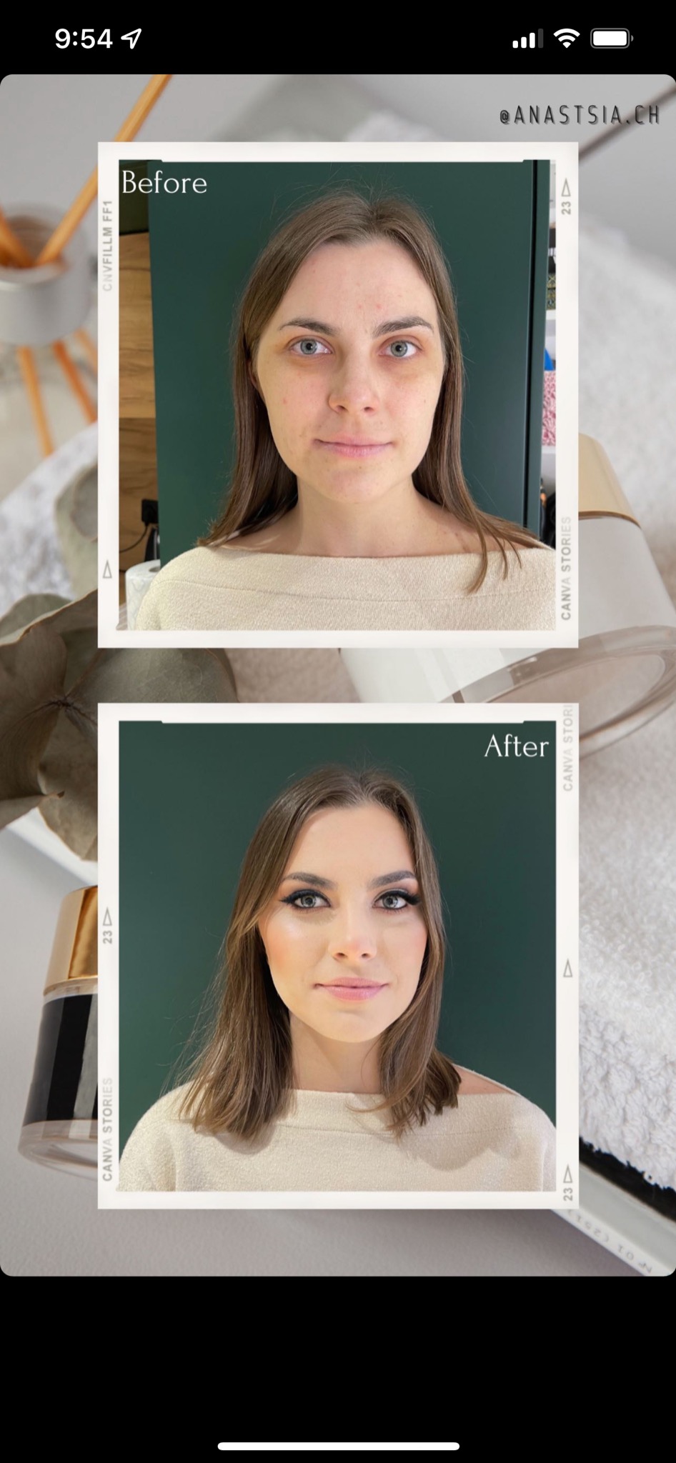 Kobieta przed i po wykonaniu profesjonalnego upiększenia, widoczne wyraźne zmiany w wyglądzie, zwłaszcza w okolicach oczu i ust, prezentacja w formie kolażu z napisem 'Before' i 'After'...