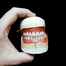 Model szczęki z protezą zębową, trzymany w dłoni na czarnym tle, widoczne oznaczenia na modelu gipsowym.
