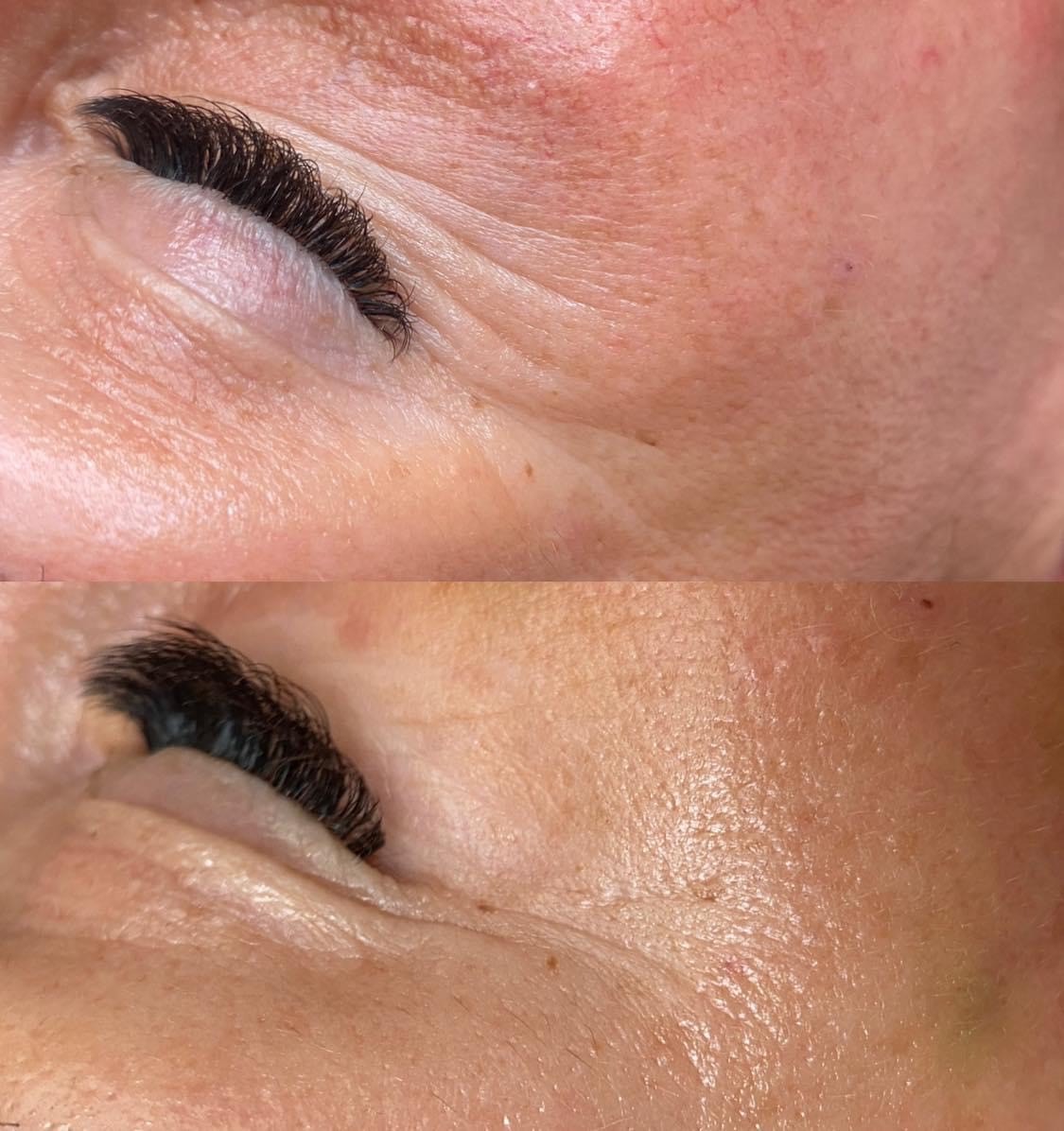 Zbliżenie na oko przed i po zabiegu przedłużania rzęs; widoczna różnica w gęstości i długości rzęs.