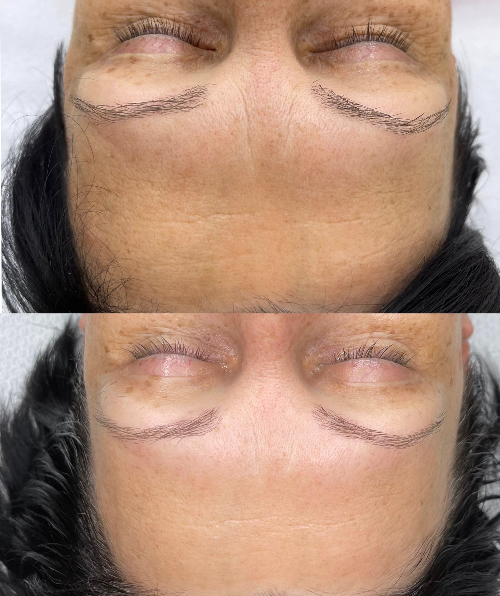 Zbliżenie na twarz kobiety przed i po zabiegu mikropigmentacji brwi, widoczne różnice w kształcie i kolorze brwi, z delikatnym zaczerwienieniem skóry po zabiegu.