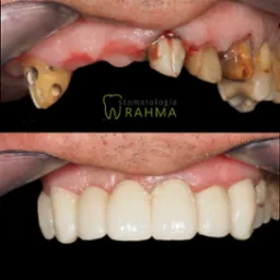 Metamorfoza uśmiechu