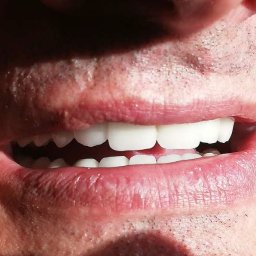 Protetyk Świnoujście 4