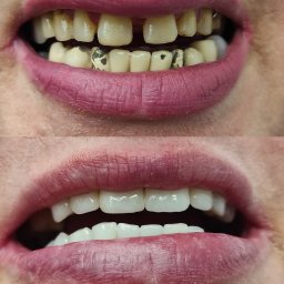 Protetyk Świnoujście 3