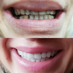 Protetyk Świnoujście 2