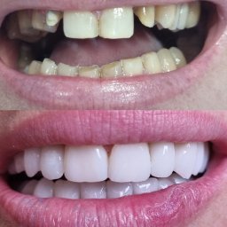 Protetyk Świnoujście 1