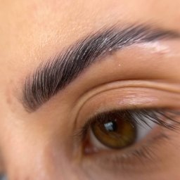 Depilacja laserowa Wrocław 2