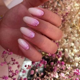 Depilacja laserowa Wrocław 3