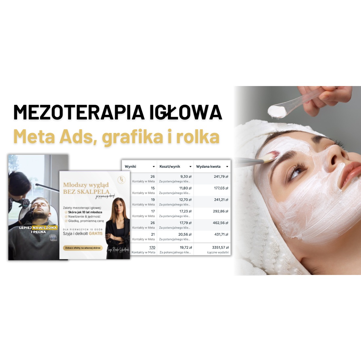 Reklama mezoterapii igłowej z Meta Ads, grafiką i rolką, Przeworsk. Zabieg na twarzy modelki z analizą kosztów kampanii reklamowej. Promocja dla nowych klientów.