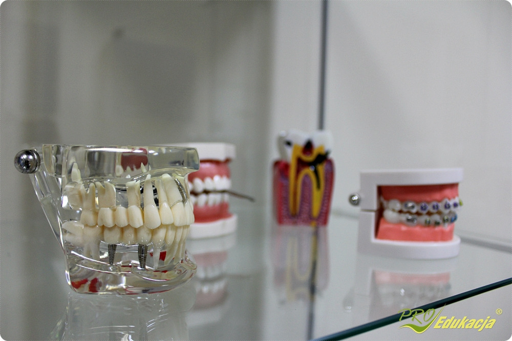 Modele edukacyjne szczęk: przezroczysta szczęka z implantami, szczęka z zębami i korzeniami, szczęka z aparatem ortodontycznym, ustawione na szklanej półce.
