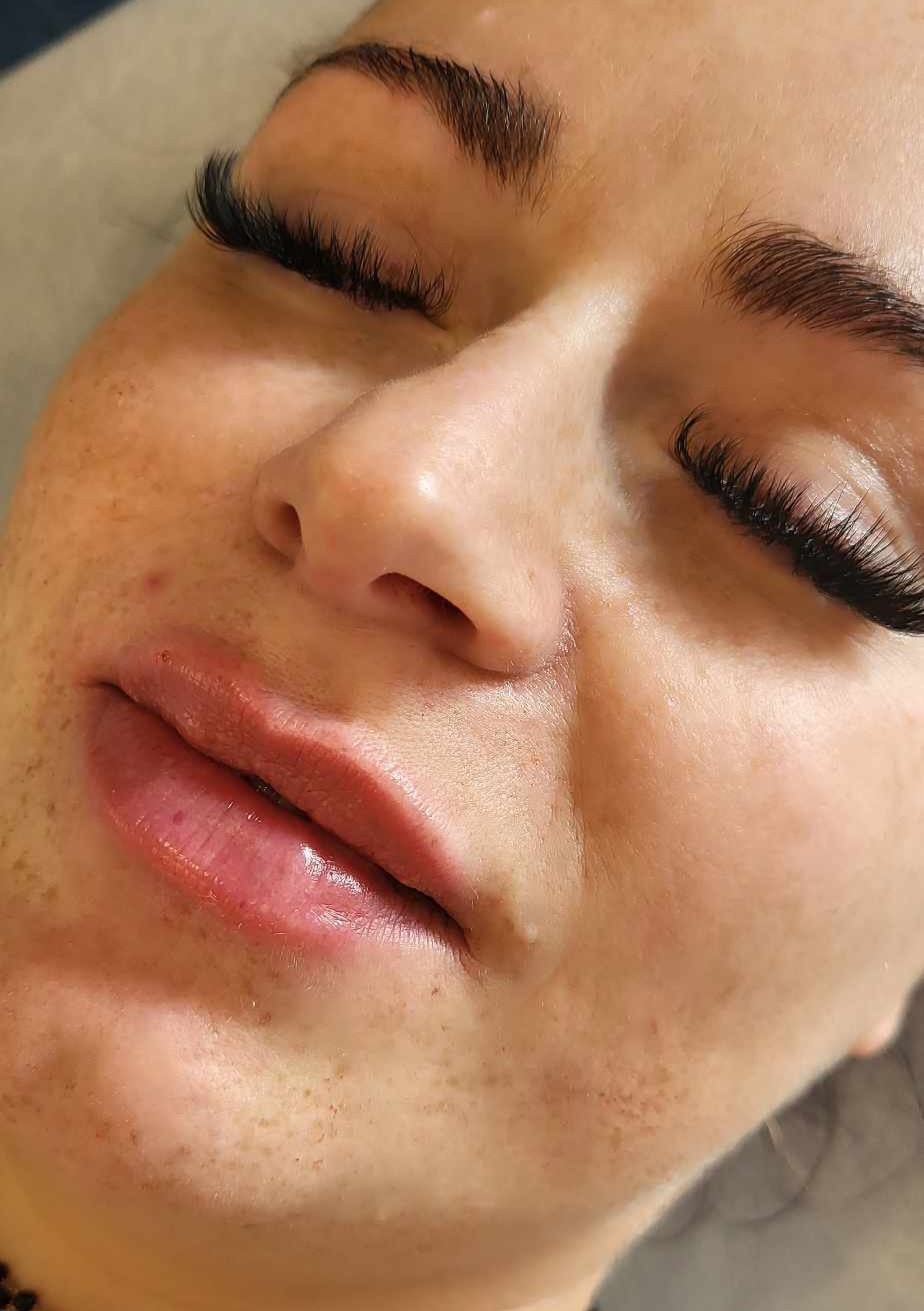 Zbliżenie na twarz kobiety po zabiegu powiększania ust, widoczne pełne, błyszczące usta i przedłużone rzęsy.