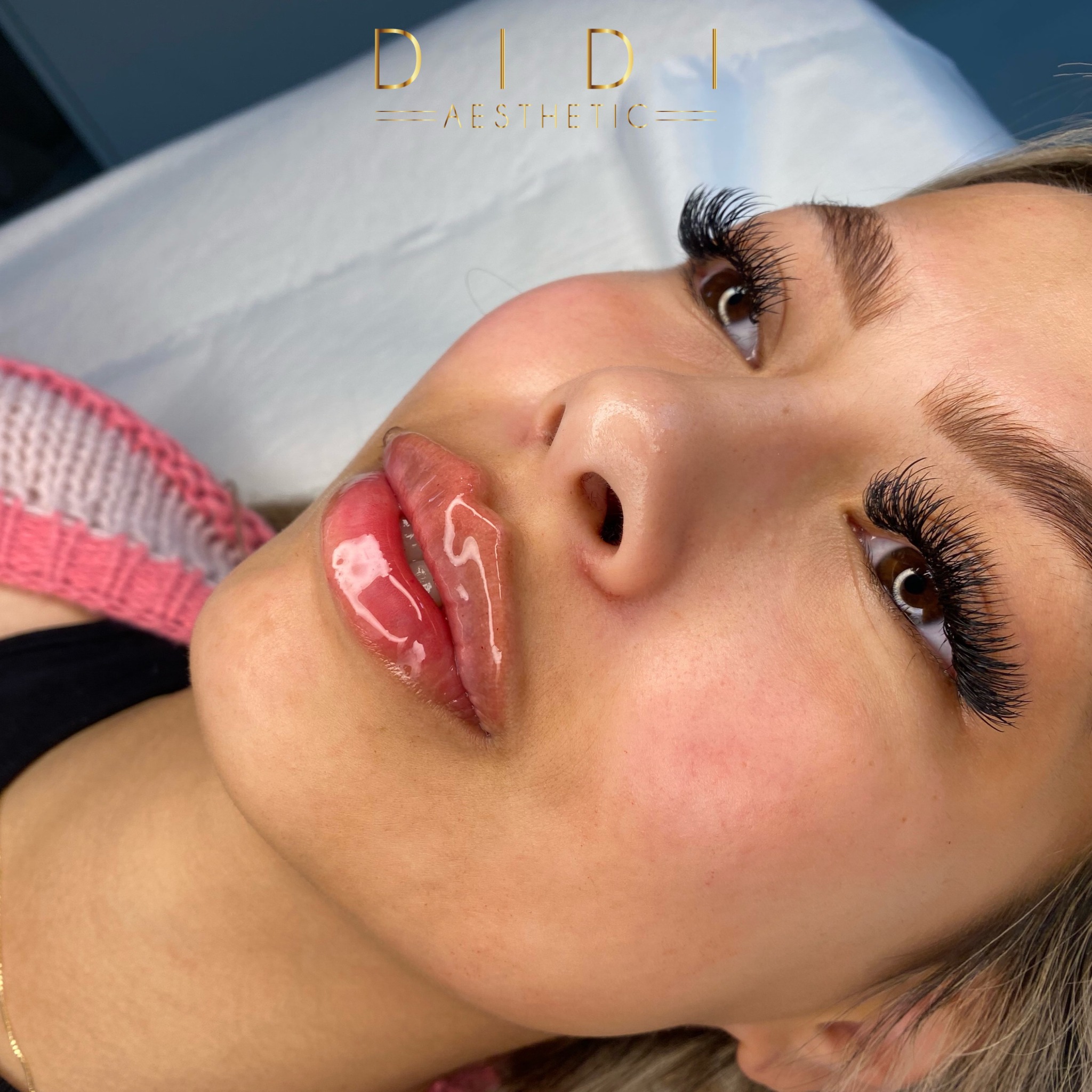 Powiększanie ust na płasko Powiększanie ust techniki rosyjskie Russian Lips Gdańsk Sopot