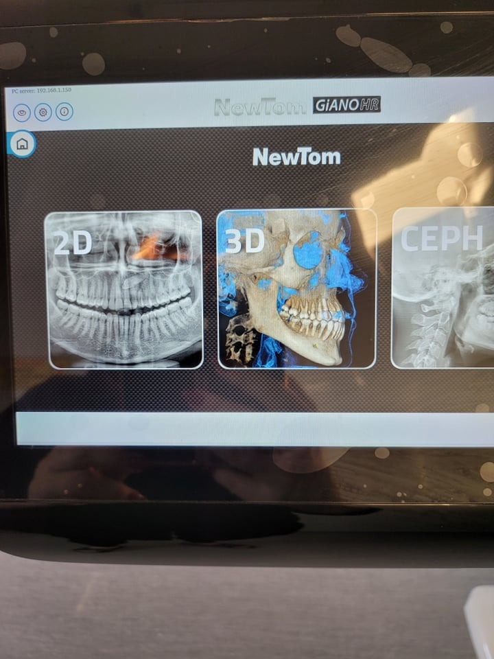 Ekran urządzenia NewTom GIANO HR prezentujący obrazy 2D, 3D i CEPH szczęki i zębów.