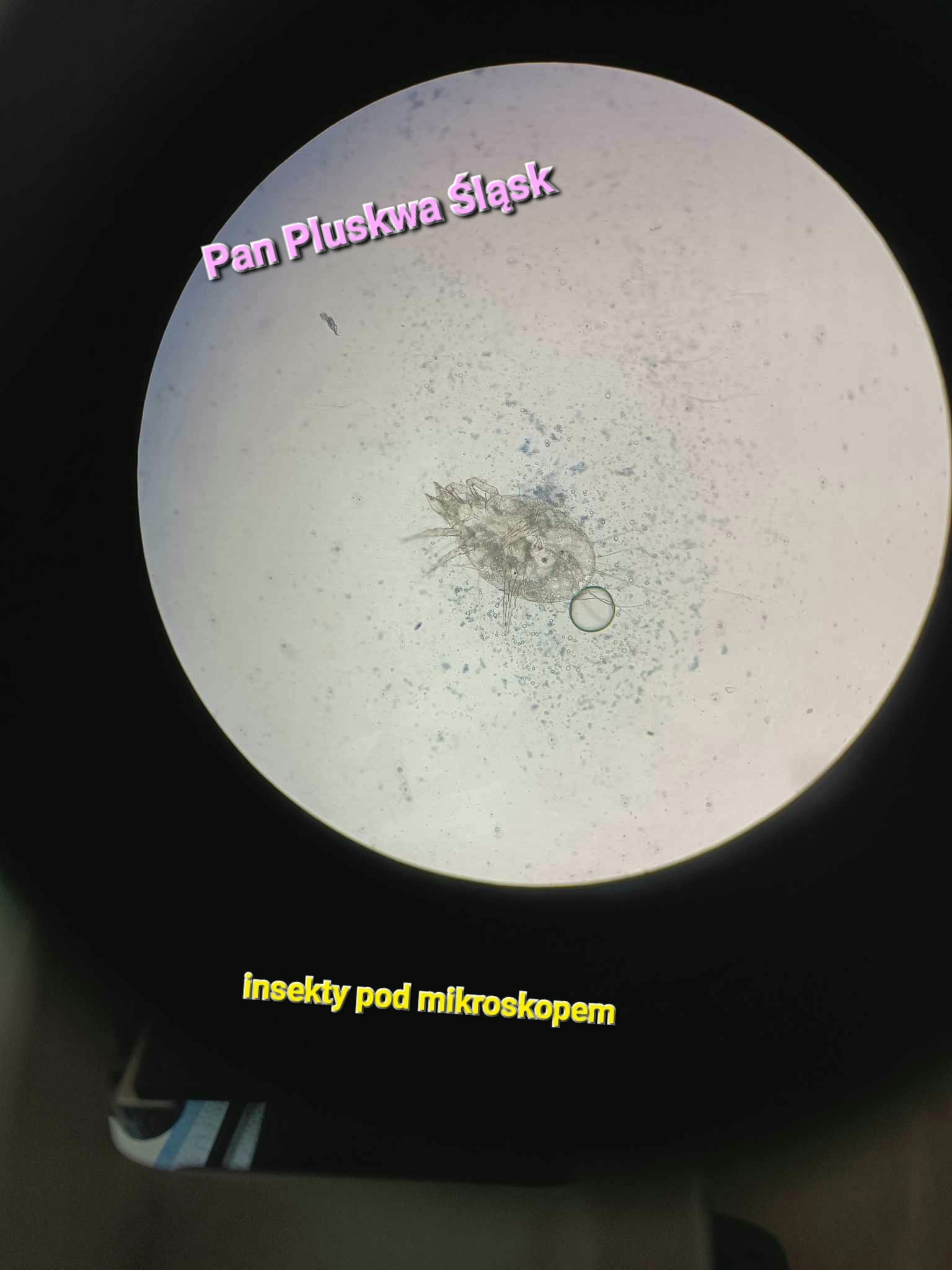 Powiększony obraz mikroskopowy małego stawonoga, prawdopodobnie roztocza, z widocznymi szczegółami jego budowy ciała, na tle zanieczyszczonego preparatu mikroskopowego.