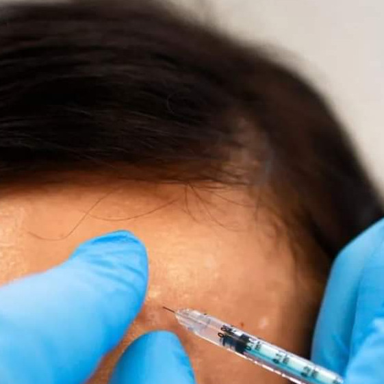 Dr Lorens podczas iniekcji botoksu