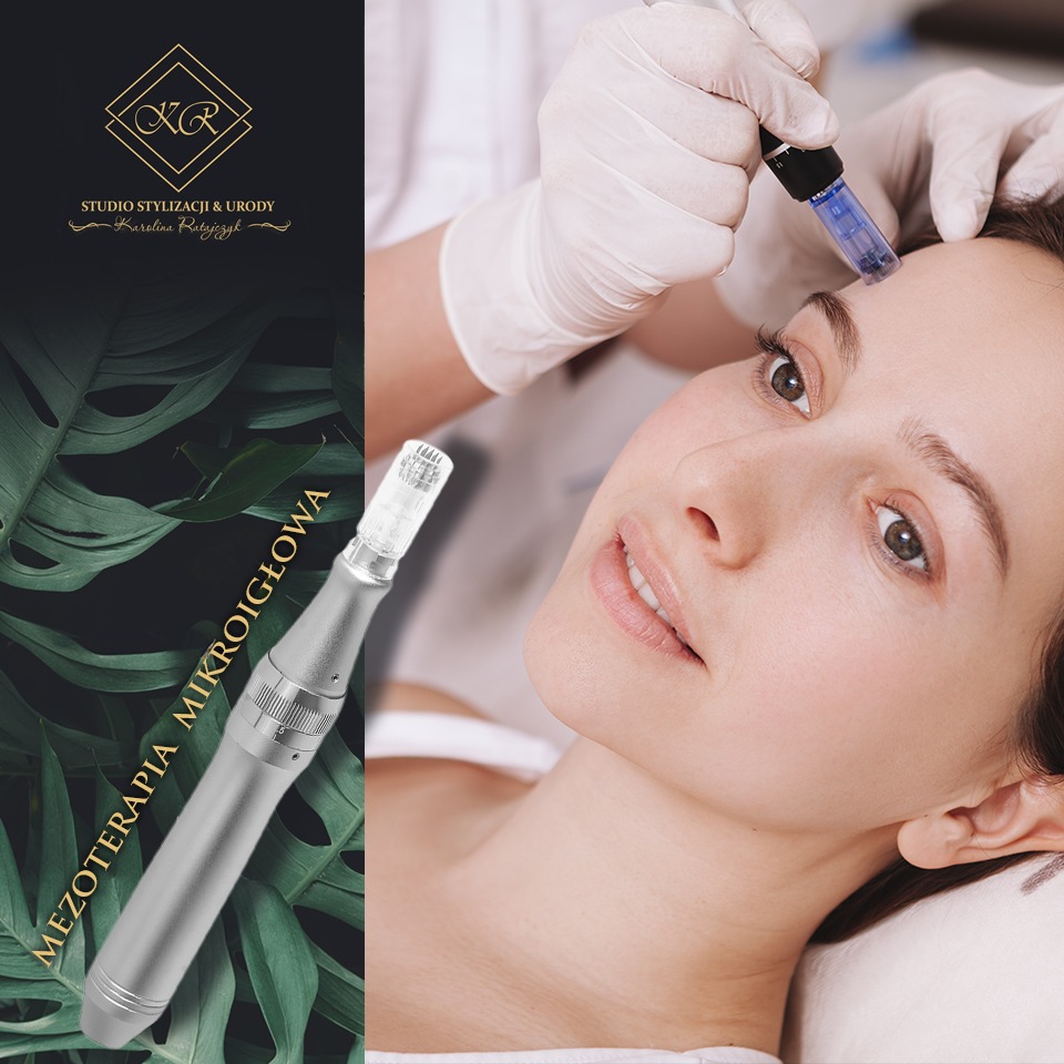 Zabieg mezoterapii mikroigłowej na czole pacjentki, wykonywany przez osobę w rękawiczkach ochronnych, z użyciem specjalistycznego urządzenia. W tle logo salonu.