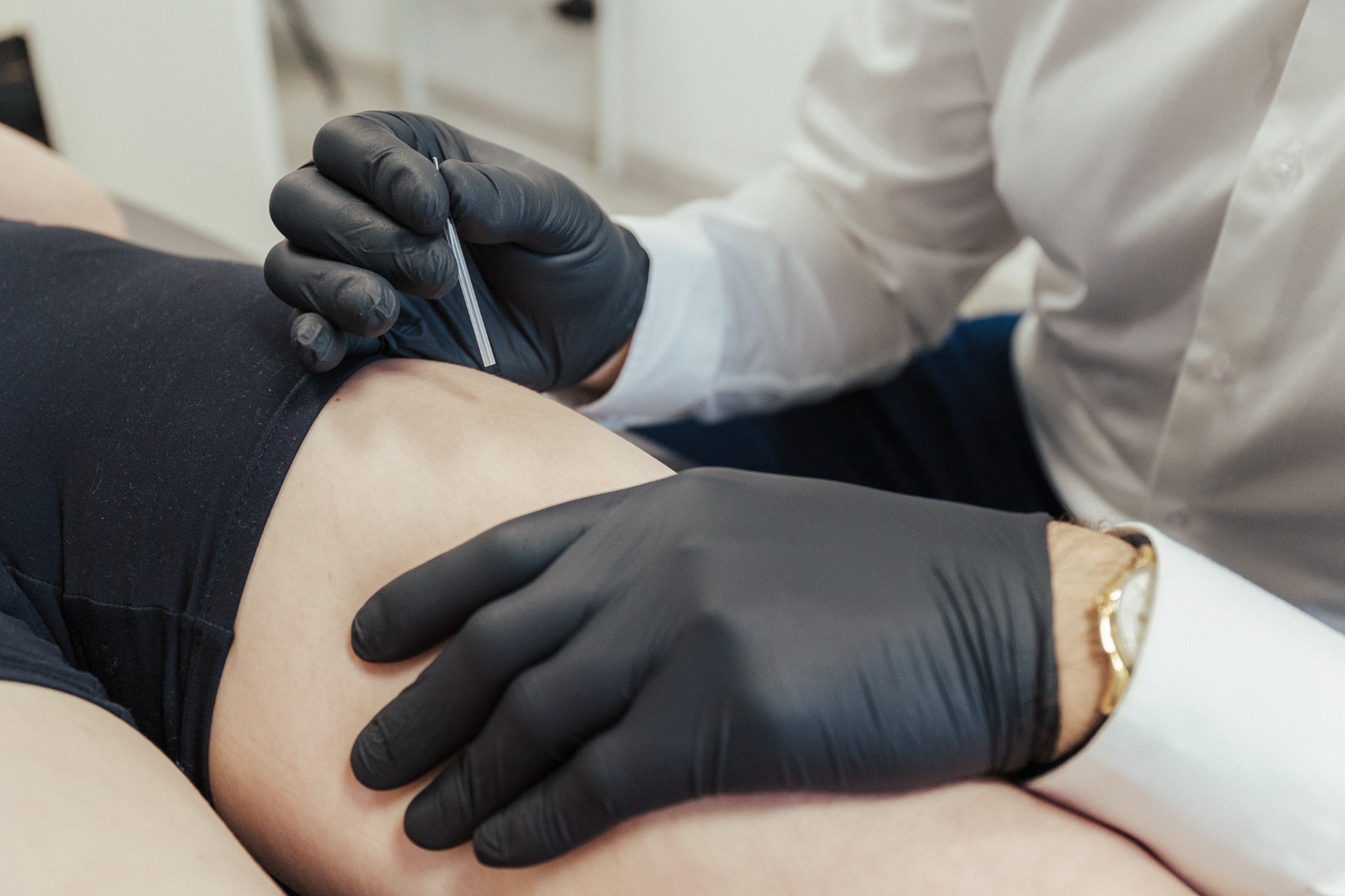 Igła akupunkturowa wprowadzana w udo pacjenta przez osobę w czarnych rękawiczkach, widoczny złoty zegarek na nadgarstku, białe tło.