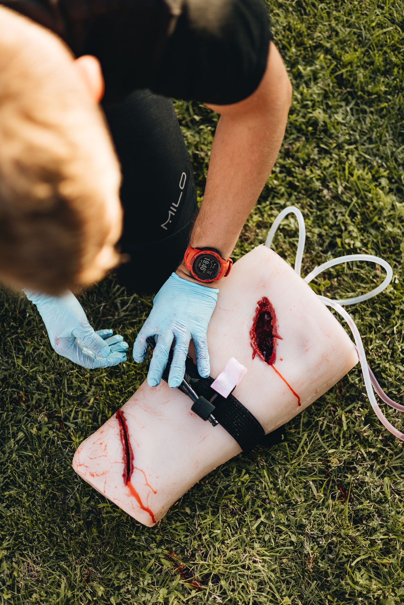 Tamowanie krwotoku - postępowanie w urazie.