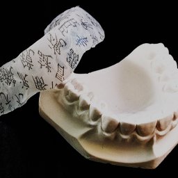 KarDent Lab & Academy - Gipsowy model szczęki z nałożoną przezroczystą nakładką z czarnymi wzorami, obok logo firmy KarDent na czarnym tle.