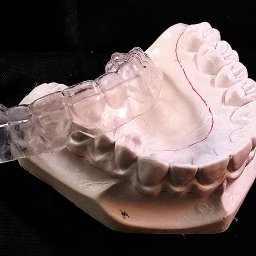 KarDent Lab & Academy - Przezroczysta szyna relaksacyjna na gipsowym modelu szczęki z zaznaczoną linią dziąseł, logo firmy KarDent w prawym dolnym rogu na czarnym tle.