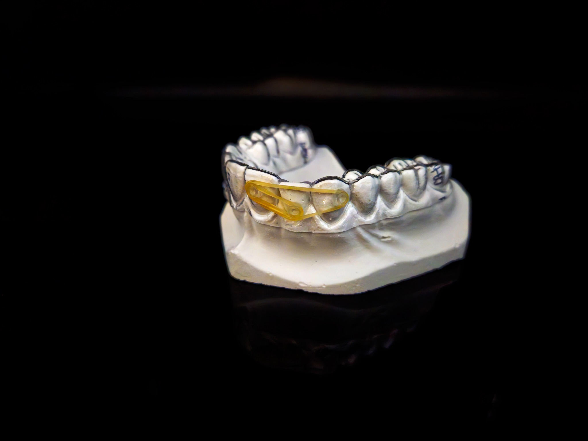 Gipsowy model szczęki z założonym żółtym gumowym separatorem ortodontycznym, widoczne oznaczenia na zębach, ciemne tło.