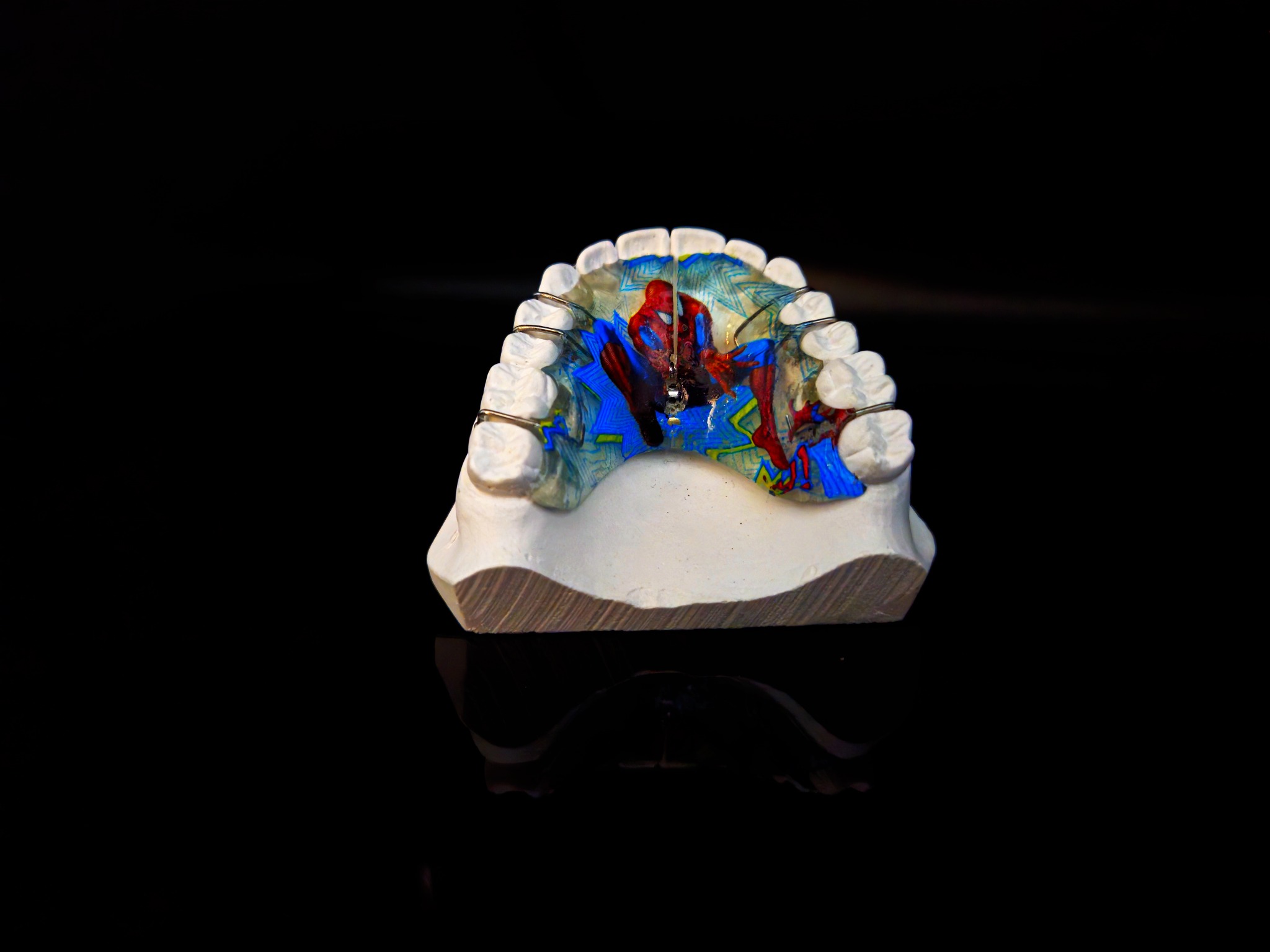 Model gipsowy szczęki z zamocowanym aparatem ortodontycznym z motywem Spider-Mana na czarnym, błyszczącym tle.