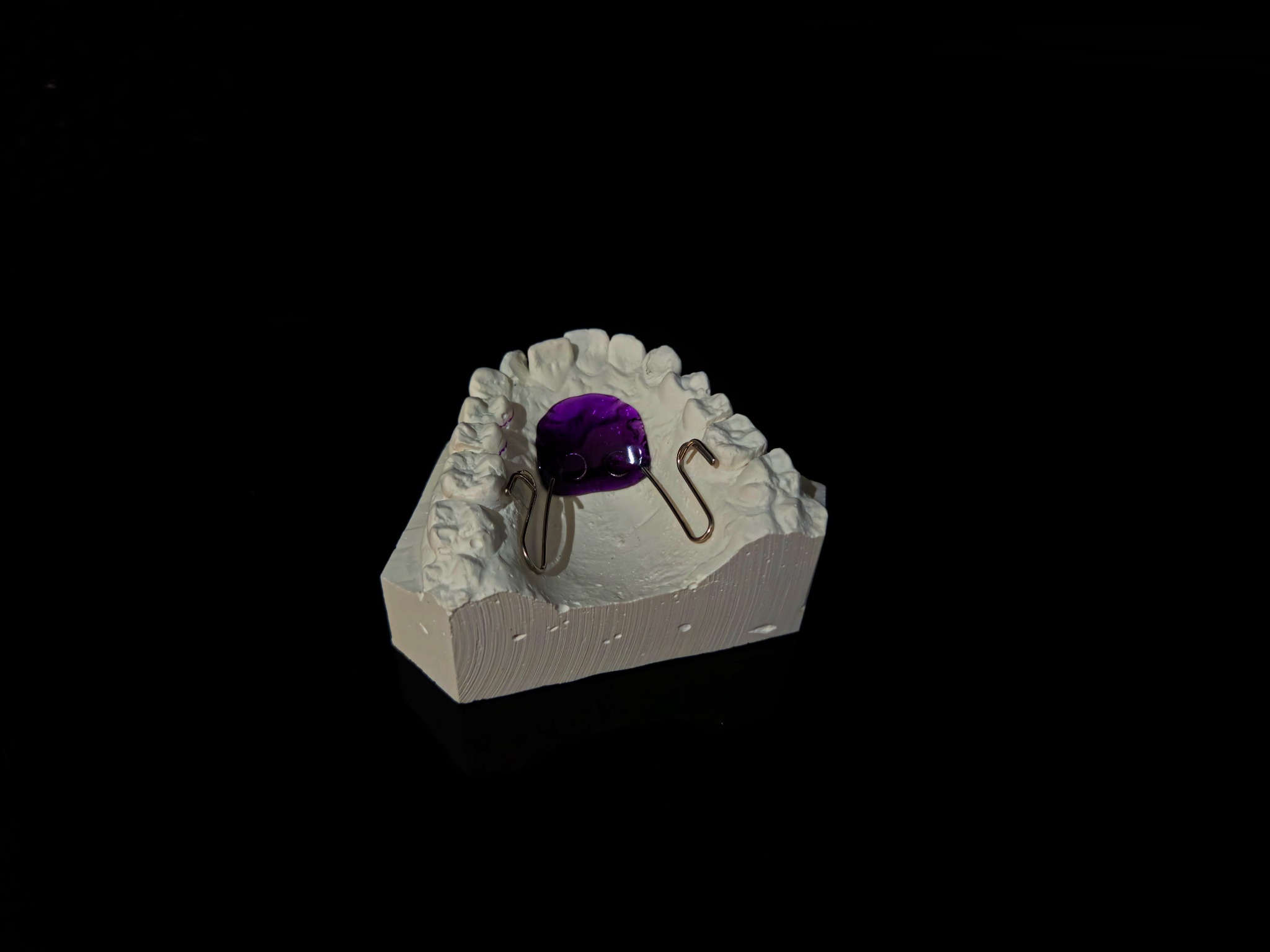 Model gipsowy szczęki z założonym aparatem ortodontycznym z fioletowym elementem akrylowym, na czarnym tle.