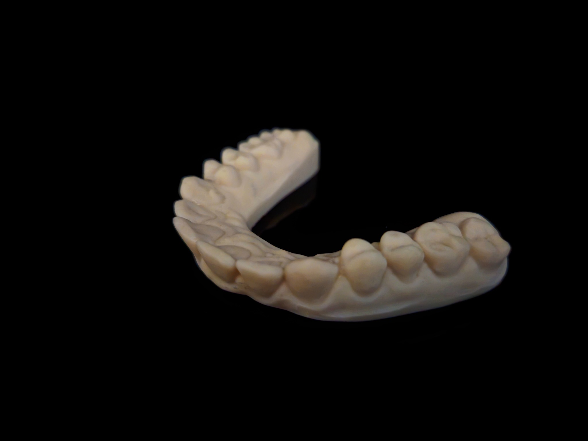 Gipsowy model dolnego łuku zębowego na czarnym tle, prezentujący anatomię zębów i dziąseł.