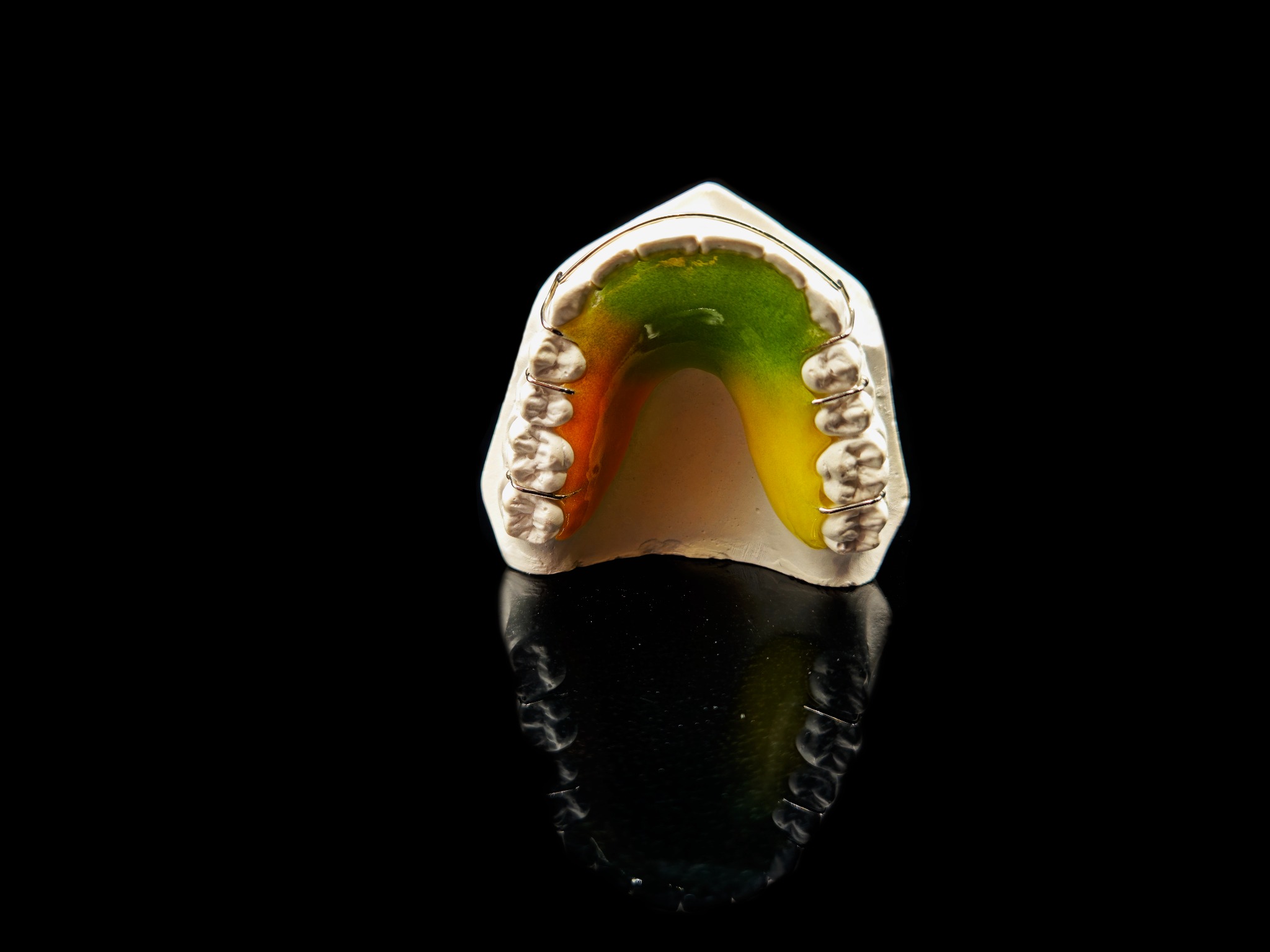 Model gipsowy szczęki z kolorową, tęczową płytką retencyjną i metalowym drucikiem, na czarnym, błyszczącym tle.