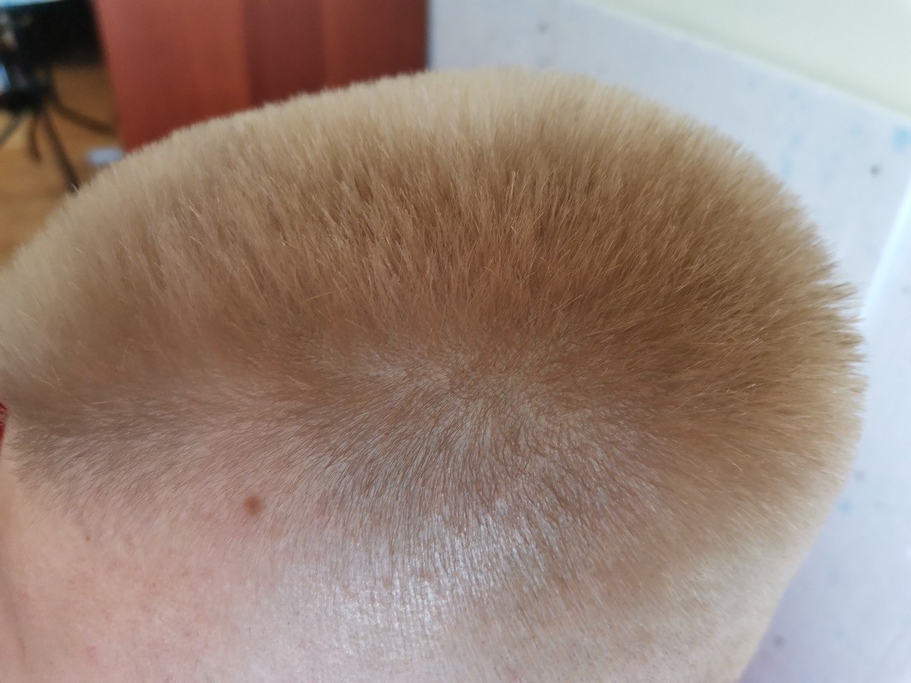 Krótko ostrzyżone, jasne włosy męskie widziane z góry, ukazujące teksturę i linię włosów.