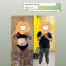 Fizjoterapeuta Warszawa 2