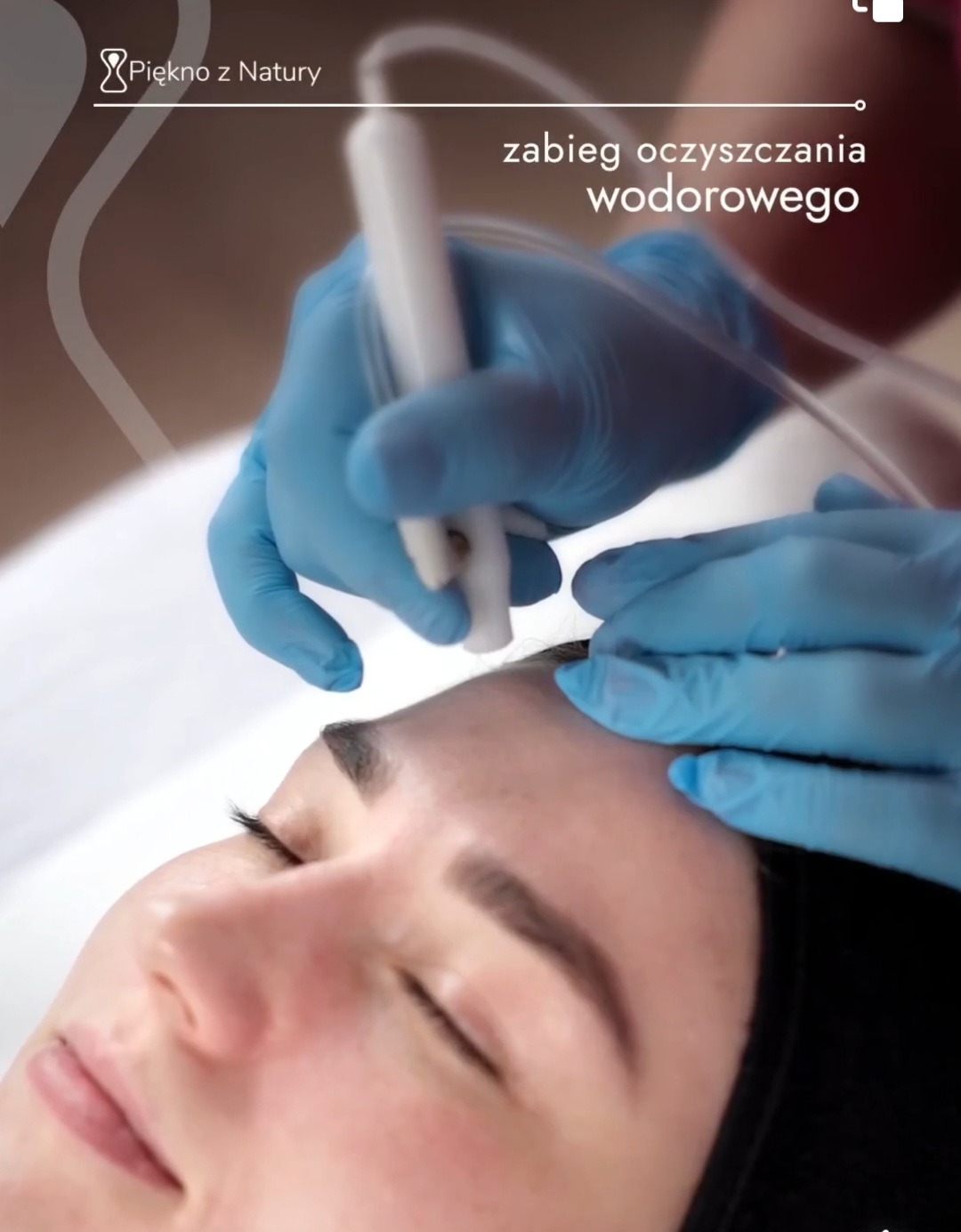 Zabieg oczyszczania wodorowego twarzy wykonywany przez osobę w niebieskich rękawiczkach, widok z bliska na skórę pacjentki.