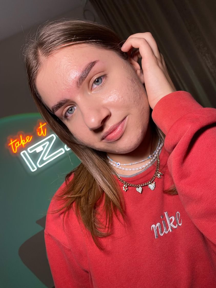 Twarz młodej kobiety z zaczerwienioną skórą wokół brwi po regulacji, widoczne lekkie niedoskonałości cery, ubrana w czerwoną bluzę Nike, z neonowym napisem w tle.