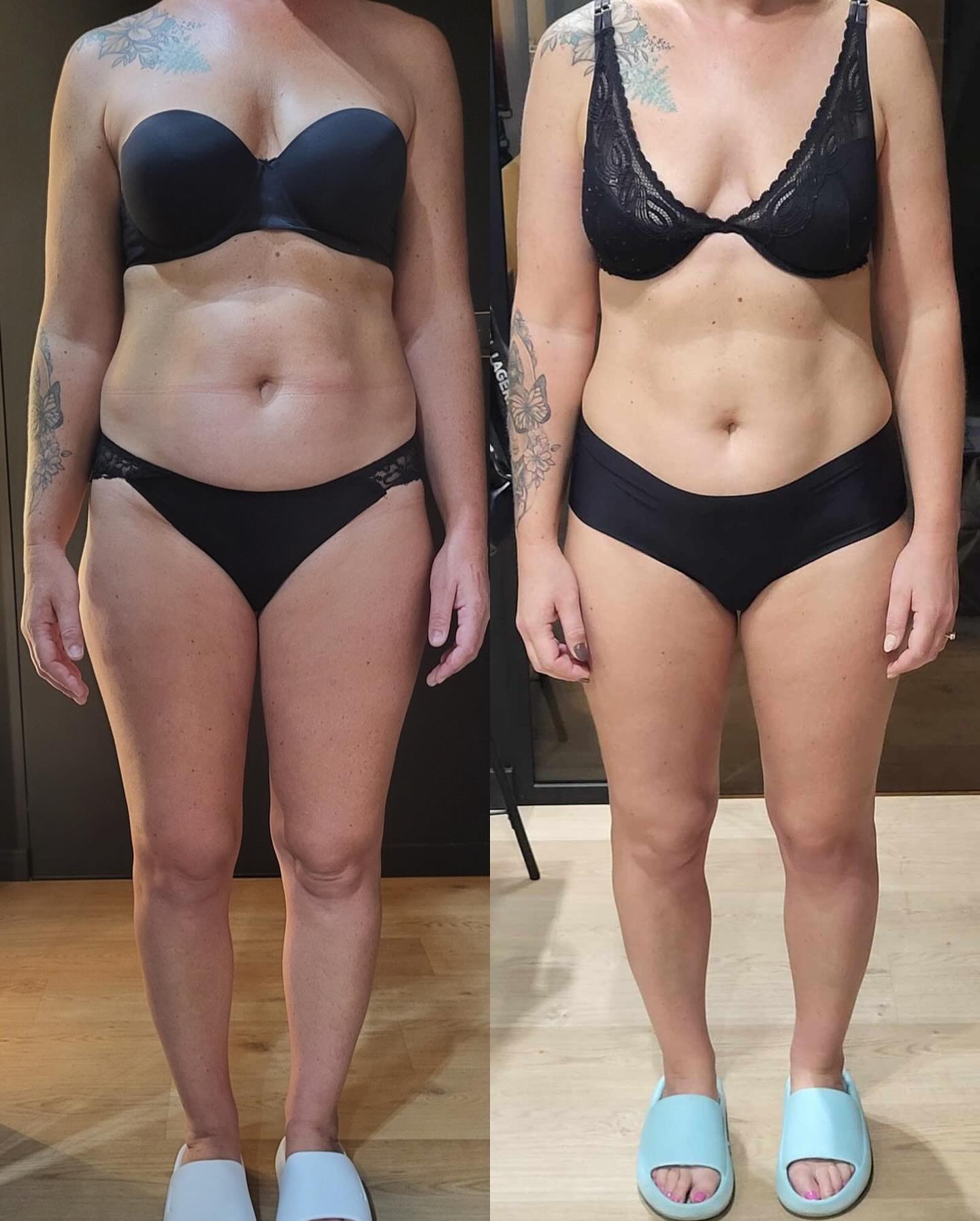 Zdjęcie 'przed i po' metamorfozy sylwetki kobiety w bieliźnie, z widocznymi tatuażami na ramionach i delikatną różnicą w wyglądzie brzucha i ud.