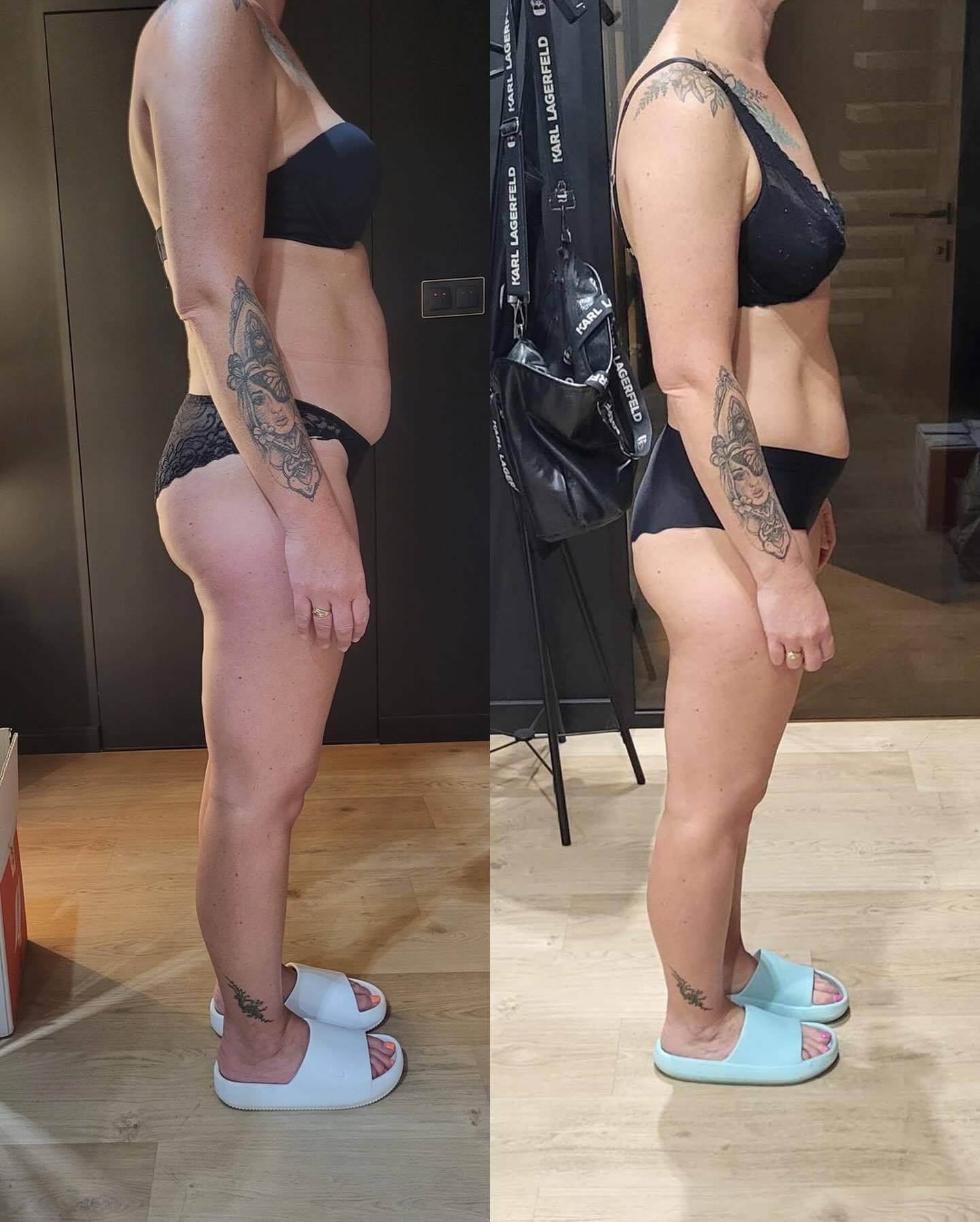 Efekt metamorfozy sylwetki kobiety, prezentowany na zdjęciu typu 'przed i po' w bieliźnie, z widocznym tatuażem na ramieniu. Zmiana w postawie i kształcie ciała.