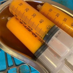 Medi Medic Centrum Medyczne - Lipotransfer