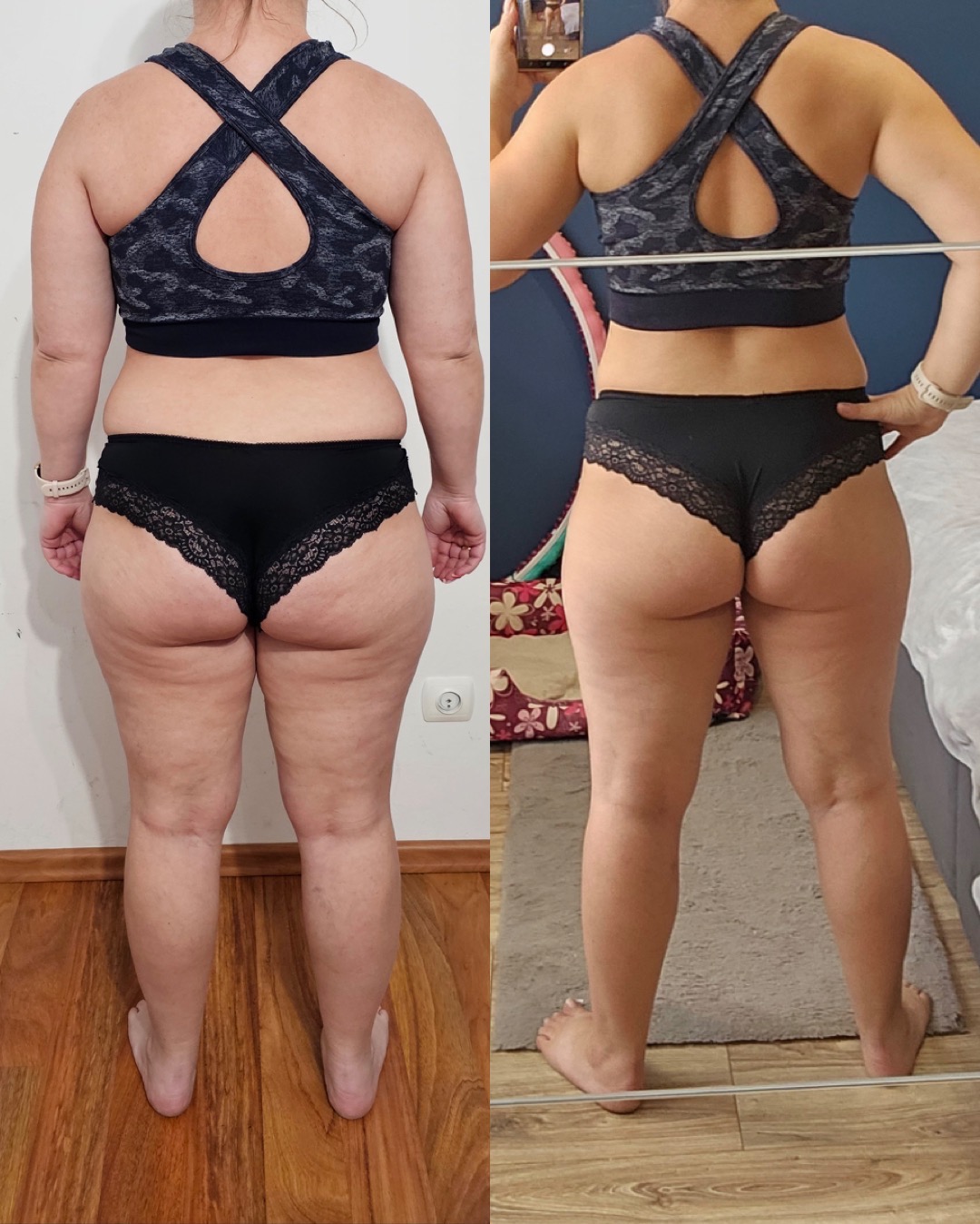 Zdjęcie typu przed i po, prezentujące metamorfozę sylwetki kobiety, widok z tyłu, z widoczną zmianą w wyglądzie pośladków i ud, na drugim ujęciu kobieta trzyma telefon w dłoni.