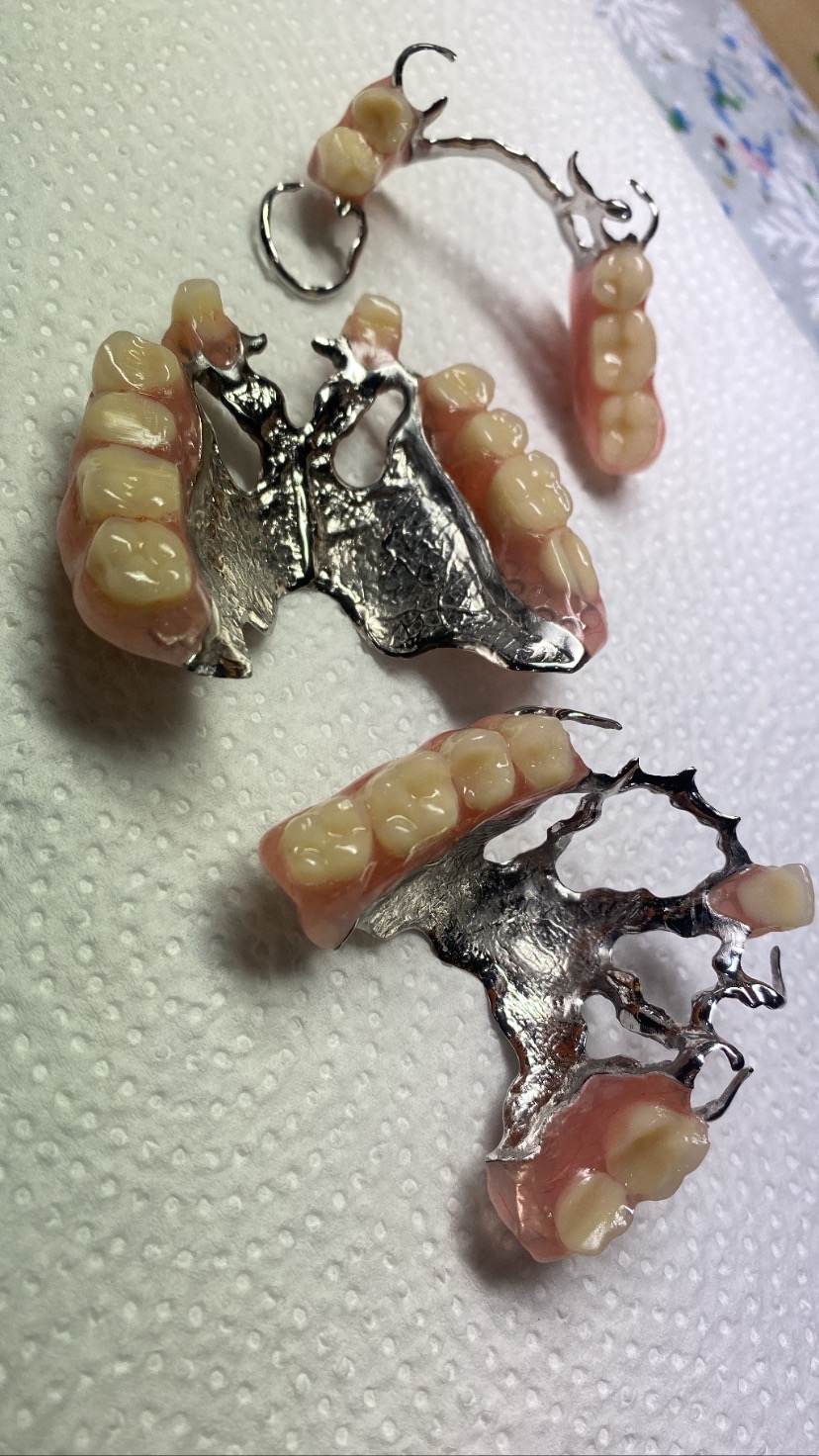 Metalowa proteza szkieletowa z akrylowymi zębami i dziąsłami, leżąca na białym papierowym podkładzie.