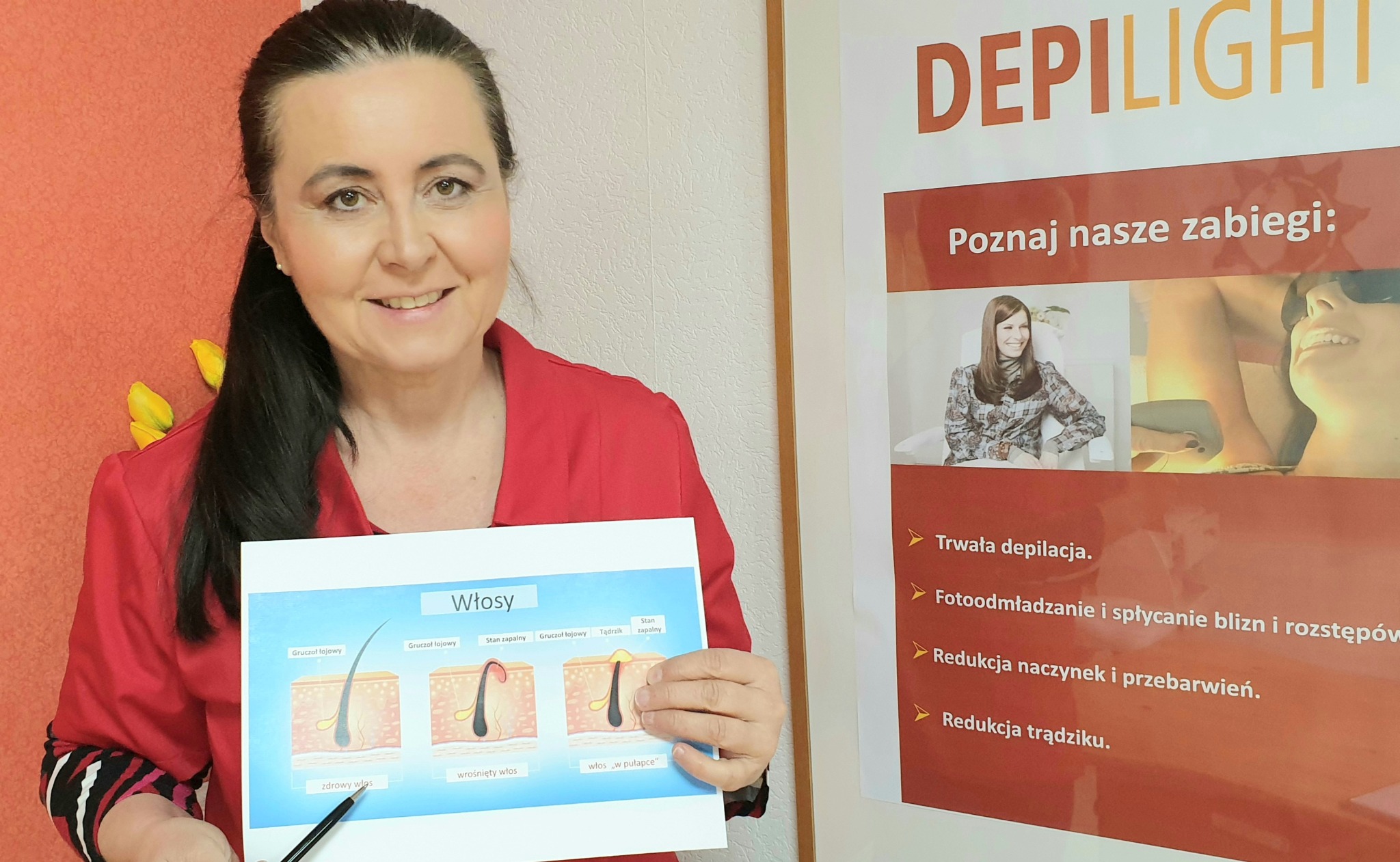 Kobieta w czerwonej bluzce prezentuje schemat budowy włosa z zaznaczonym zdrowym włosem, włosem wrastającym i włosem uwięzionym; w tle plakat reklamowy z nazwą Depilight i hasłem 'Poznaj nasze...