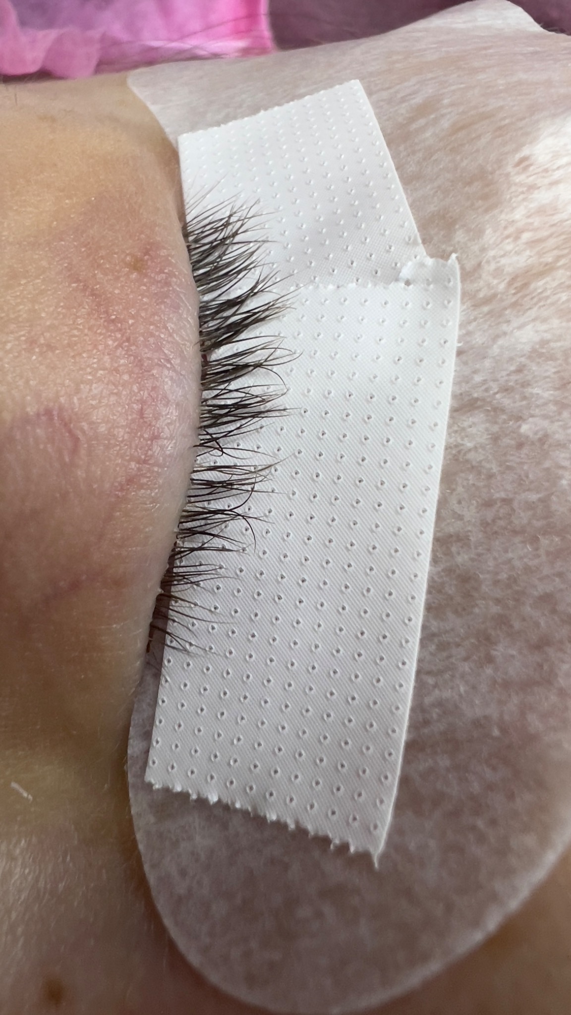 Zbliżenie na oko z przyklejonymi rzęsami i zabezpieczającym plasterkiem, widoczne delikatne zaczerwienienie skóry.