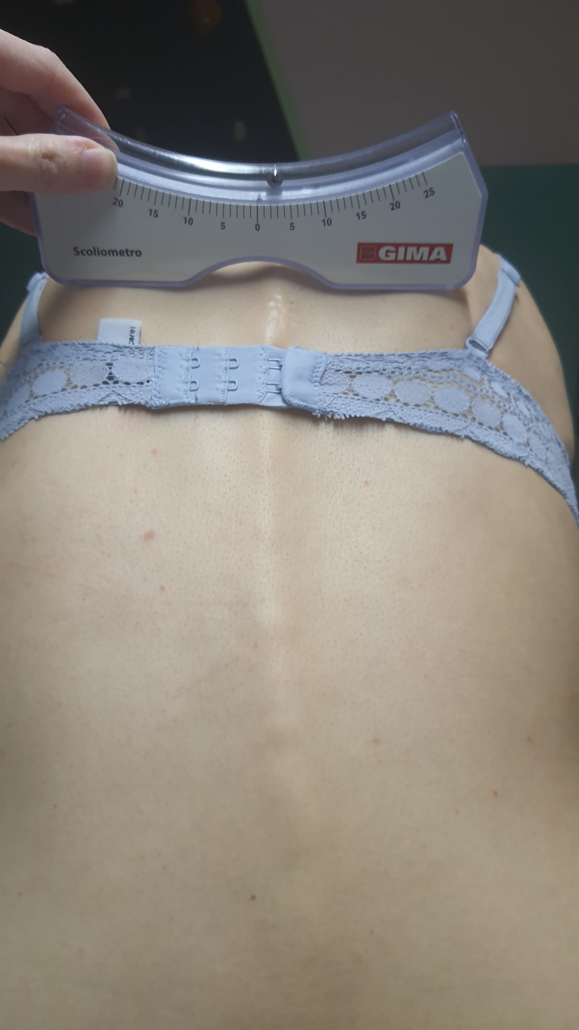 Pomiar skoliometrem na plecach pacjenta w biustonoszu, widoczny skoliometr marki GIMA z podziałką.