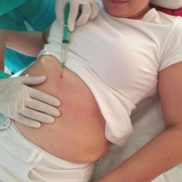 Zabiegi na ciało Poznań 1