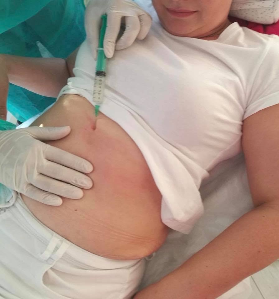 Iniekcja w okolice brzucha pacjentki, wykonywana przez osobę w białych rękawiczkach, widoczna zielona strzykawka i zaczerwienienie skóry.