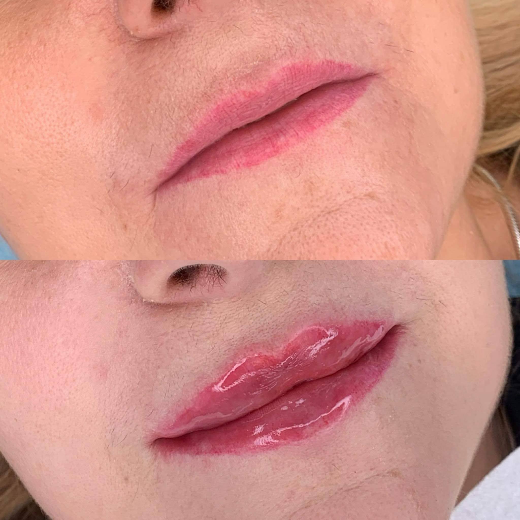 Zbliżenie na usta przed i po zabiegu makijażu permanentnego; górne ujęcie pokazuje naturalny kolor, dolne prezentuje efekt z błyszczącym wykończeniem i podkreślonym konturem.