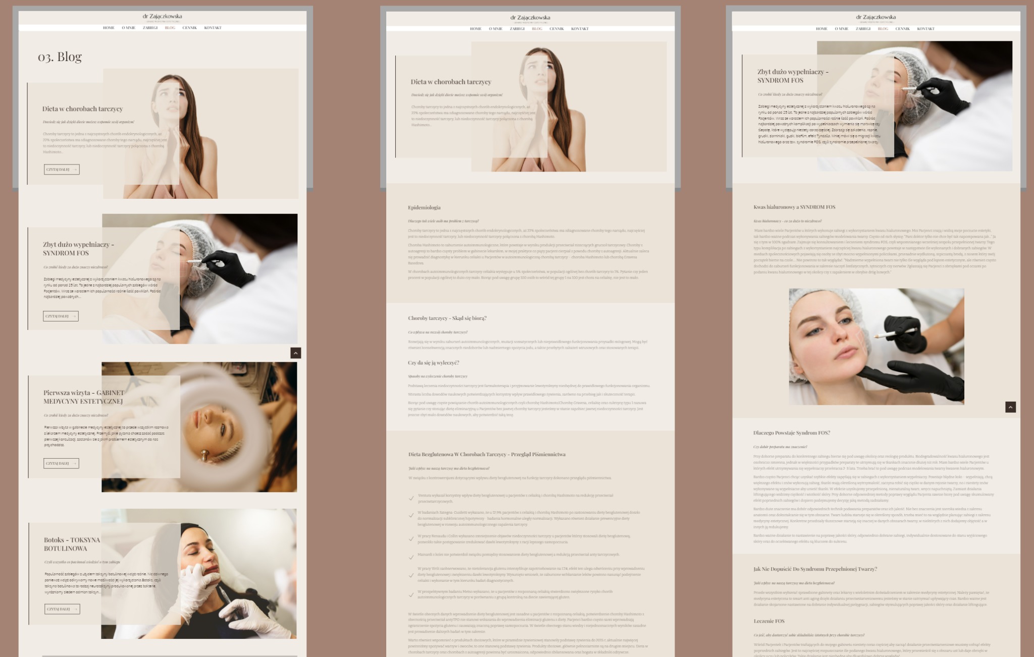 Fragment strony internetowej dr Zajączkowskiej z artykułami o tematyce medycyny estetycznej, widoczne sekcje bloga z miniaturami zabiegów i artykułów o diecie w chorobach tarczycy oraz syndromie FOS.